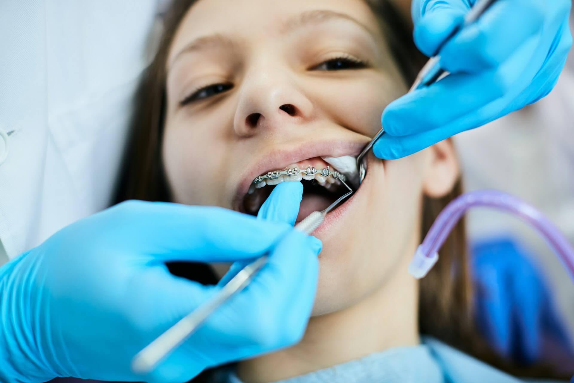 Read more about the article Болезненно ли лечить зубы